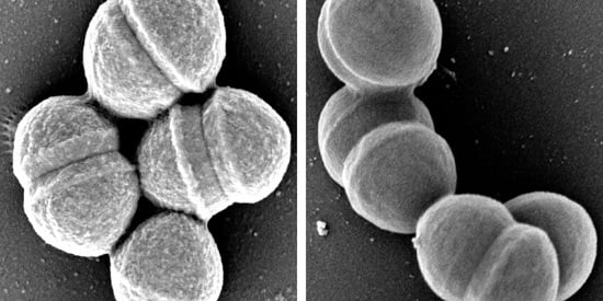 Trials of new point of care tests to help reduce overuse of antibiotics 