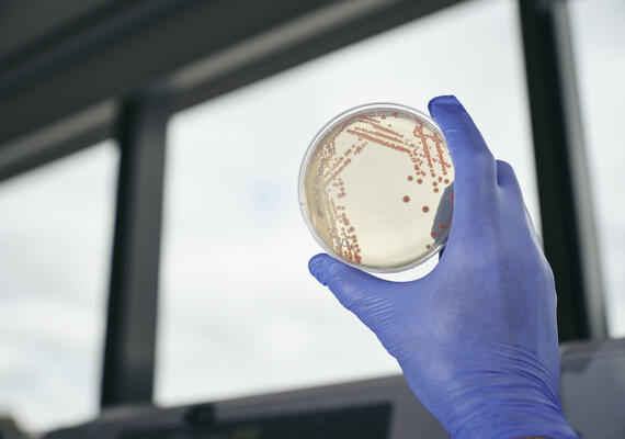 A gloved hand holds up a candida dish in science lab.